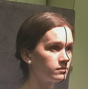 picture showing a middle line drawn down the model's face